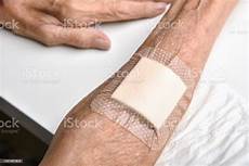 Sterile Wound Dressings