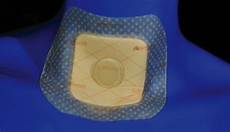 Wound Dressing Products