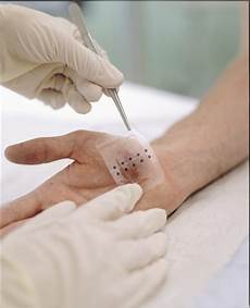 Wound Dressing