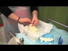 Wound Dressing