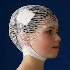 Wound Dressings