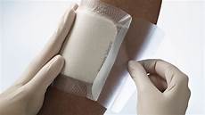 Wound Dressings